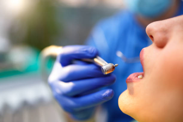 Best Wisdom Tooth Removal  in Fulton, IL